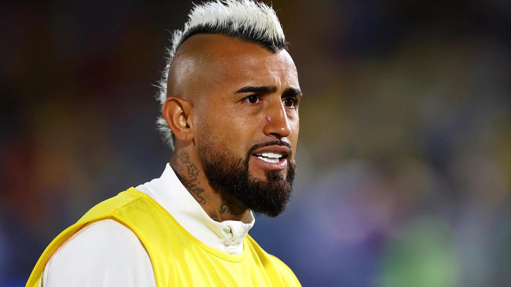 arturo-vidal-calentamiento_98